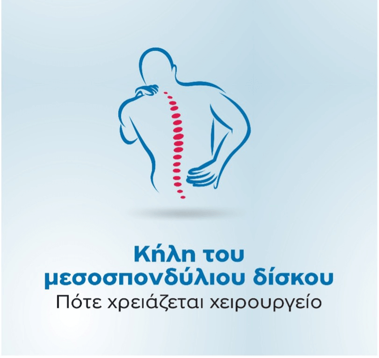 Κήλη του μεσοσπονδύλιου δίσκου – Πότε χρειάζεται χειρουργείο; 